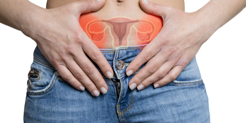 Çikolata Kisti Nedir? Neden Oluşur?